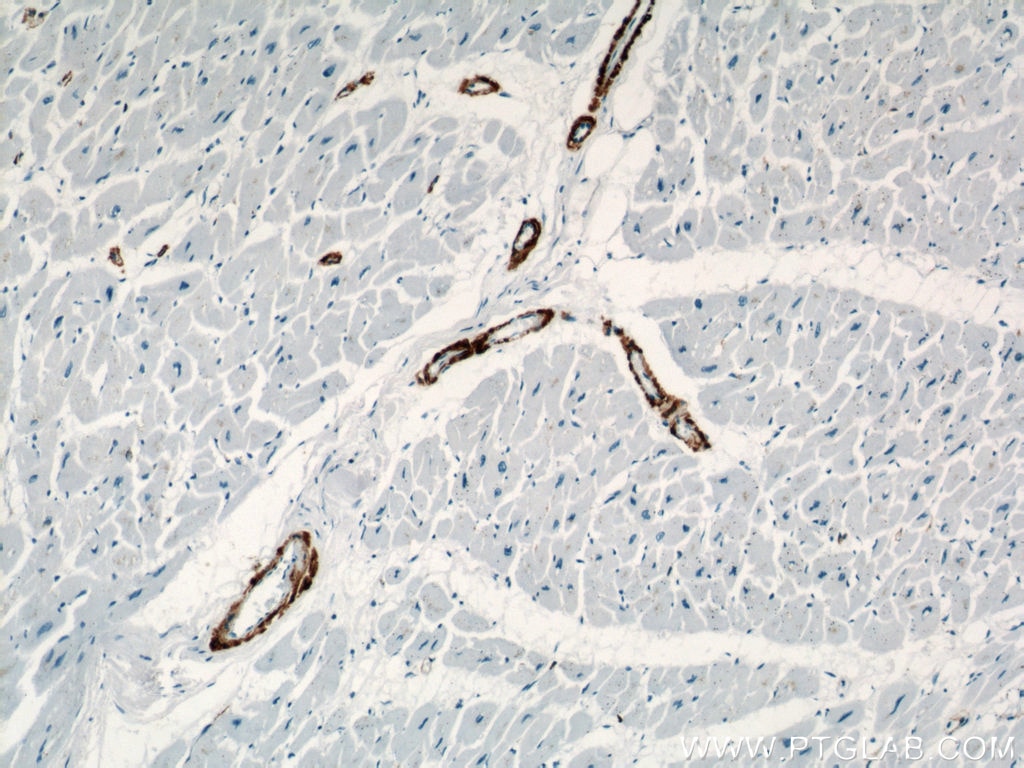 Immunohistochemistry (IHC) staining of human heart tissue using smooth muscle actin Polyclonal antibody (23081-1-AP)