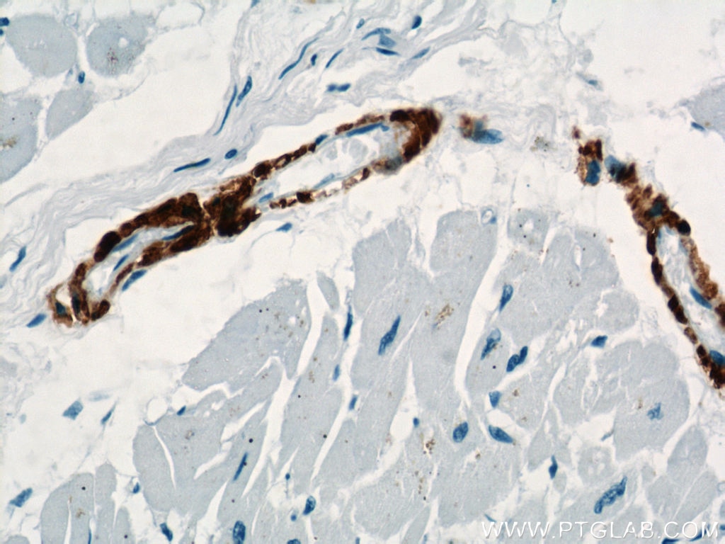 Immunohistochemistry (IHC) staining of human heart tissue using smooth muscle actin Polyclonal antibody (23081-1-AP)