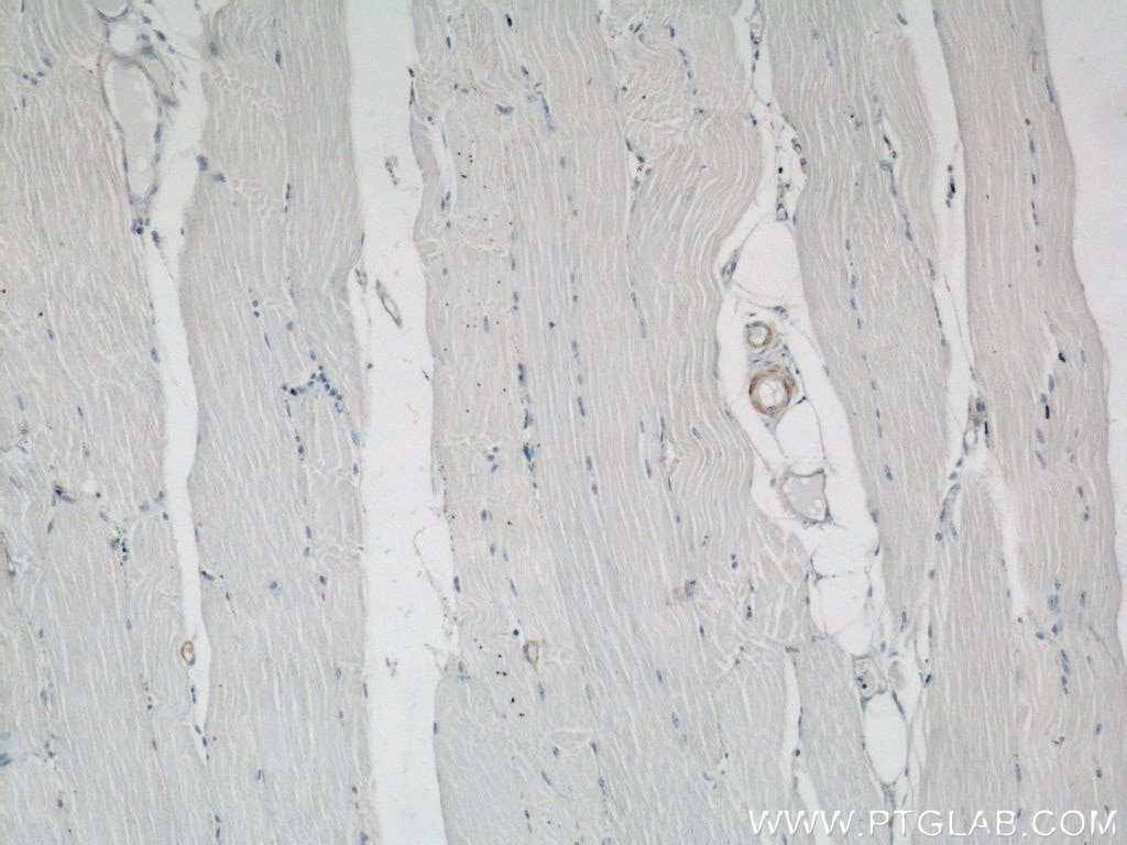 IHC staining of human skeletal muscle using 23081-1-AP