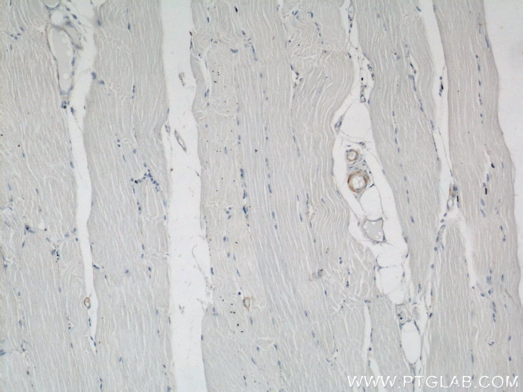 Immunohistochemistry (IHC) staining of human skeletal muscle tissue using smooth muscle actin Polyclonal antibody (23081-1-AP)