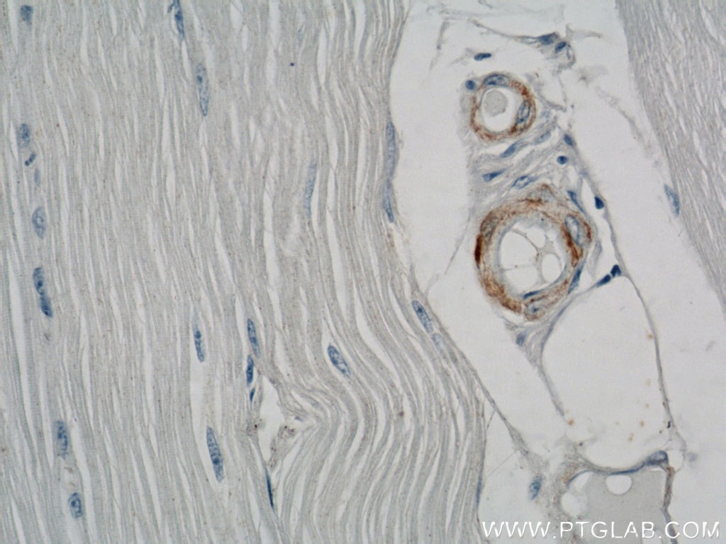 Immunohistochemistry (IHC) staining of human skeletal muscle tissue using smooth muscle actin Polyclonal antibody (23081-1-AP)