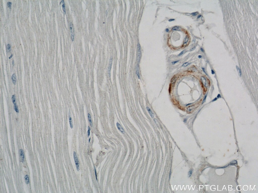 IHC staining of human skeletal muscle using 23081-1-AP