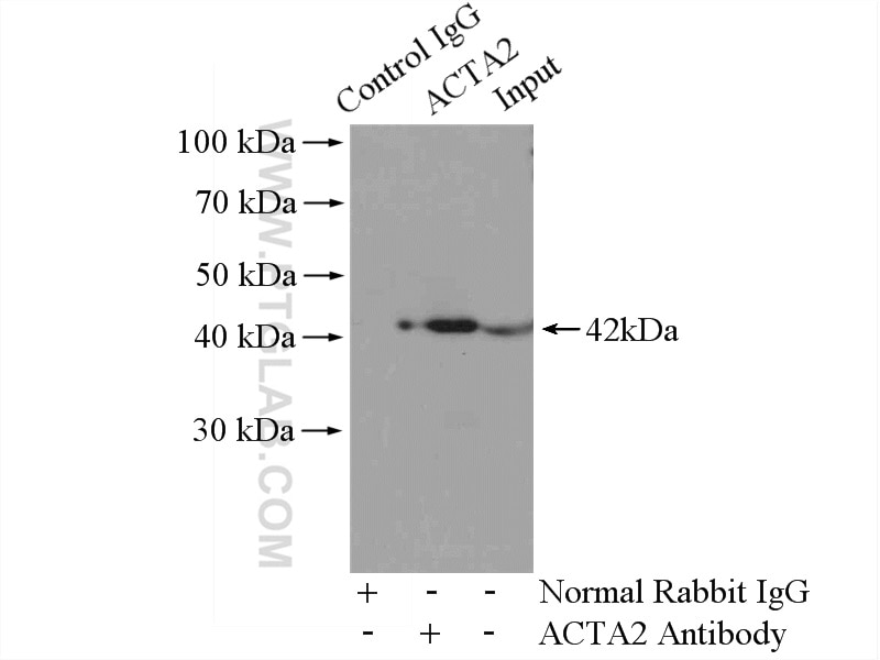 Immunoprecipitation (IP) experiment of mouse heart tissue using smooth muscle actin Polyclonal antibody (23081-1-AP)