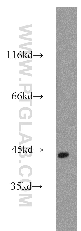 WB analysis of mouse kidney using 23081-1-AP