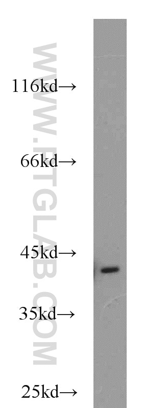 Western Blot (WB) analysis of mouse liver tissue using smooth muscle actin Polyclonal antibody (23081-1-AP)