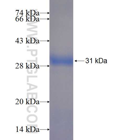 ACTA2 fusion protein Ag19481 SDS-PAGE