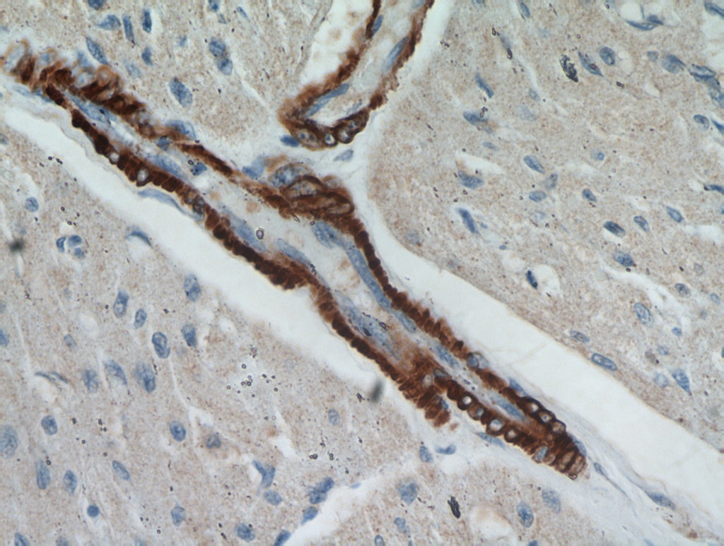 smooth muscle actin specific