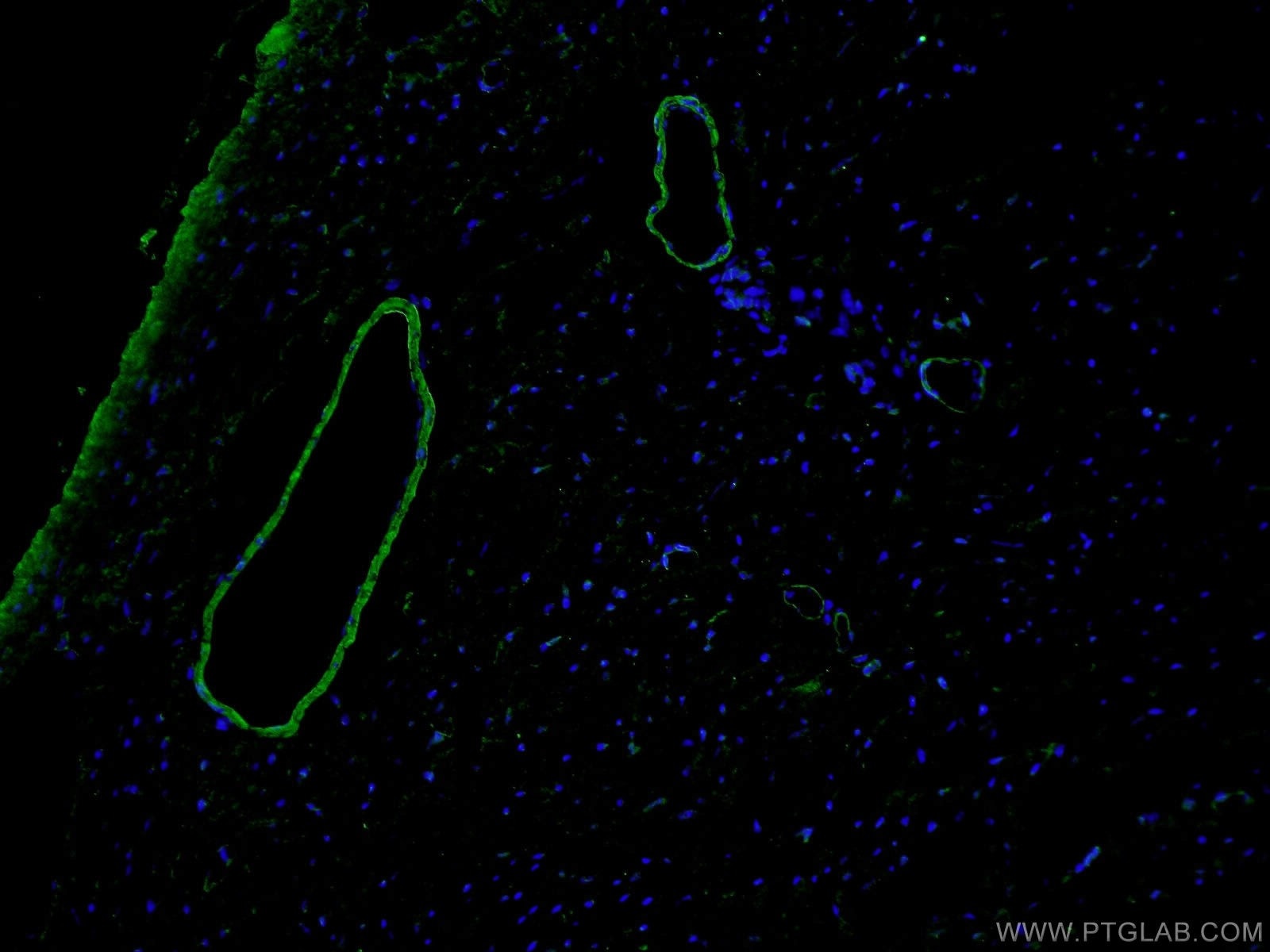 IF Staining of mouse heart using 55135-1-AP