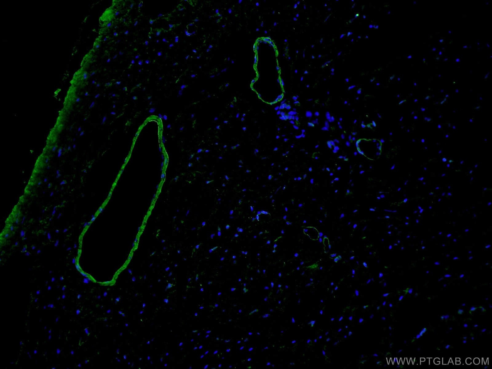 Immunofluorescence (IF) / fluorescent staining of mouse heart tissue using smooth muscle actin specific Polyclonal antibody (55135-1-AP)