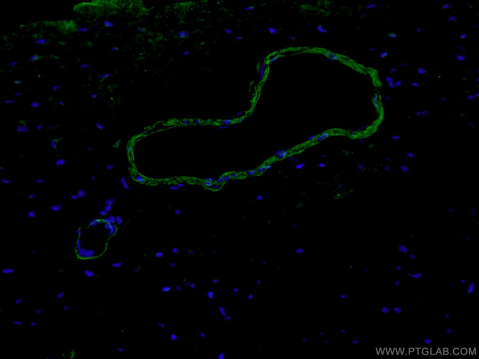 Immunofluorescence (IF) / fluorescent staining of mouse heart tissue using smooth muscle actin specific Polyclonal antibody (55135-1-AP)