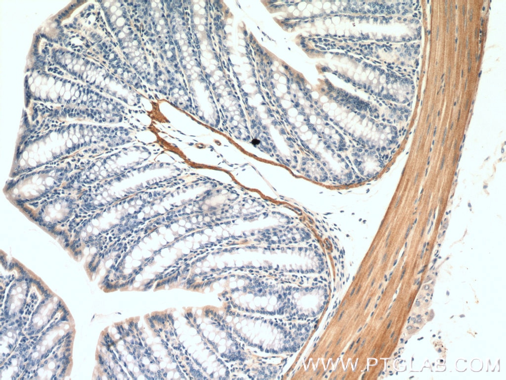 Immunohistochemistry (IHC) staining of mouse colon tissue using smooth muscle actin specific Polyclonal antibody (55135-1-AP)