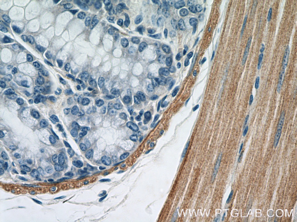 Immunohistochemistry (IHC) staining of mouse colon tissue using smooth muscle actin specific Polyclonal antibody (55135-1-AP)