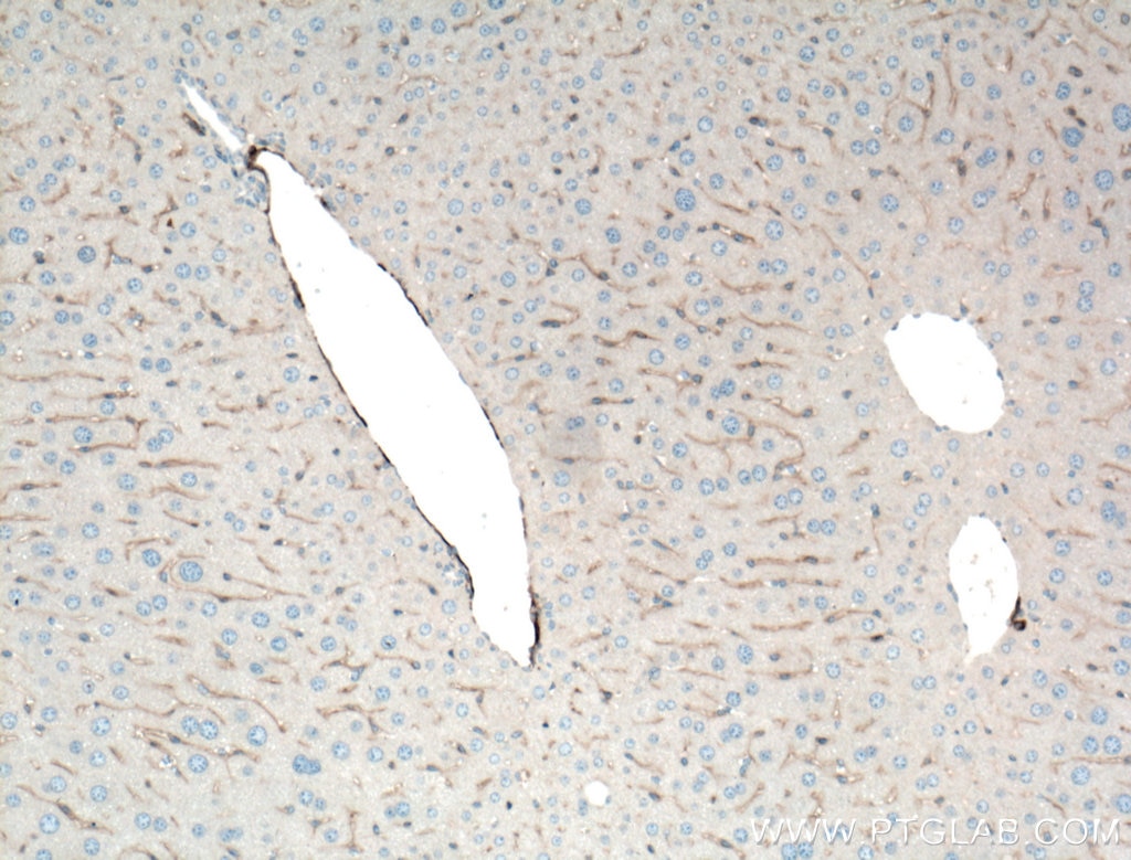 Immunohistochemistry (IHC) staining of mouse liver tissue using smooth muscle actin specific Polyclonal antibody (55135-1-AP)