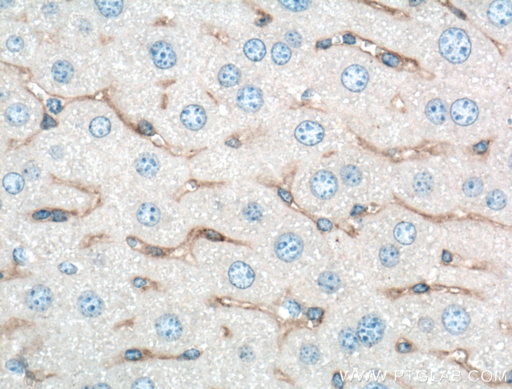 Immunohistochemistry (IHC) staining of mouse liver tissue using smooth muscle actin specific Polyclonal antibody (55135-1-AP)