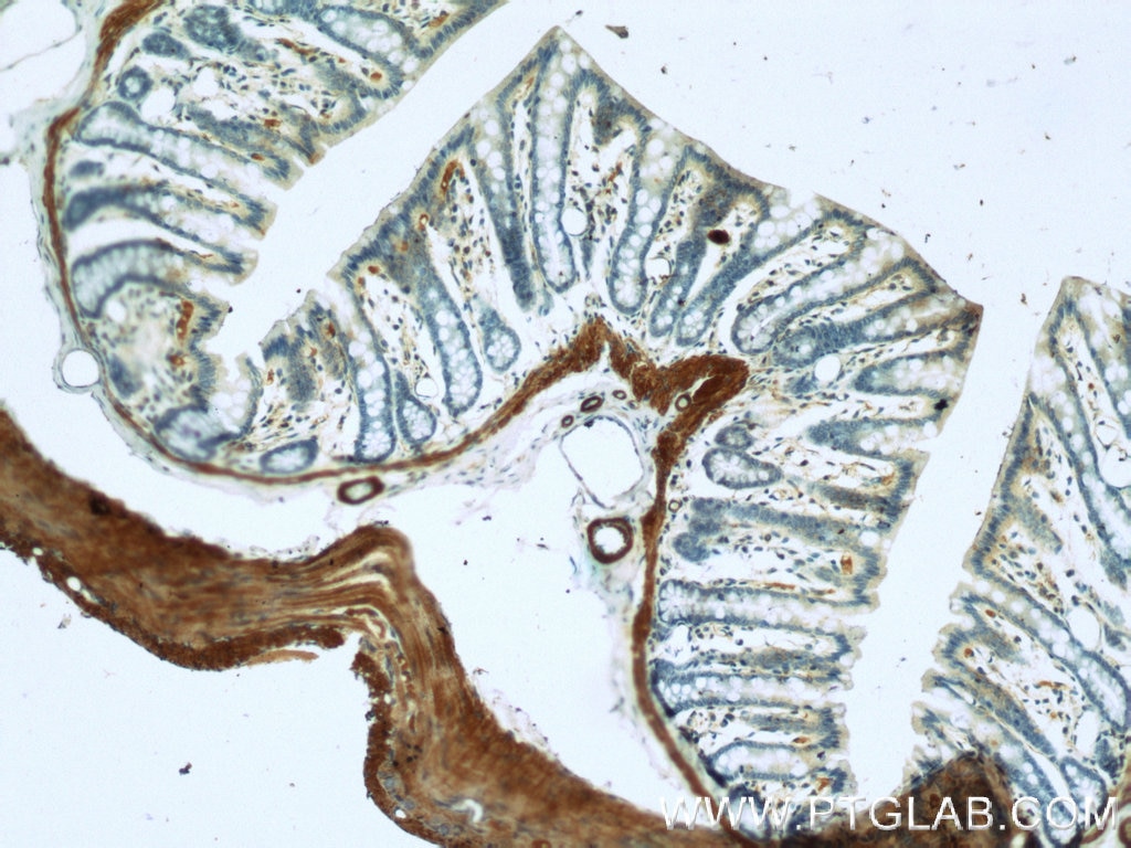 Immunohistochemistry (IHC) staining of rat colon tissue using smooth muscle actin specific Polyclonal antibody (55135-1-AP)