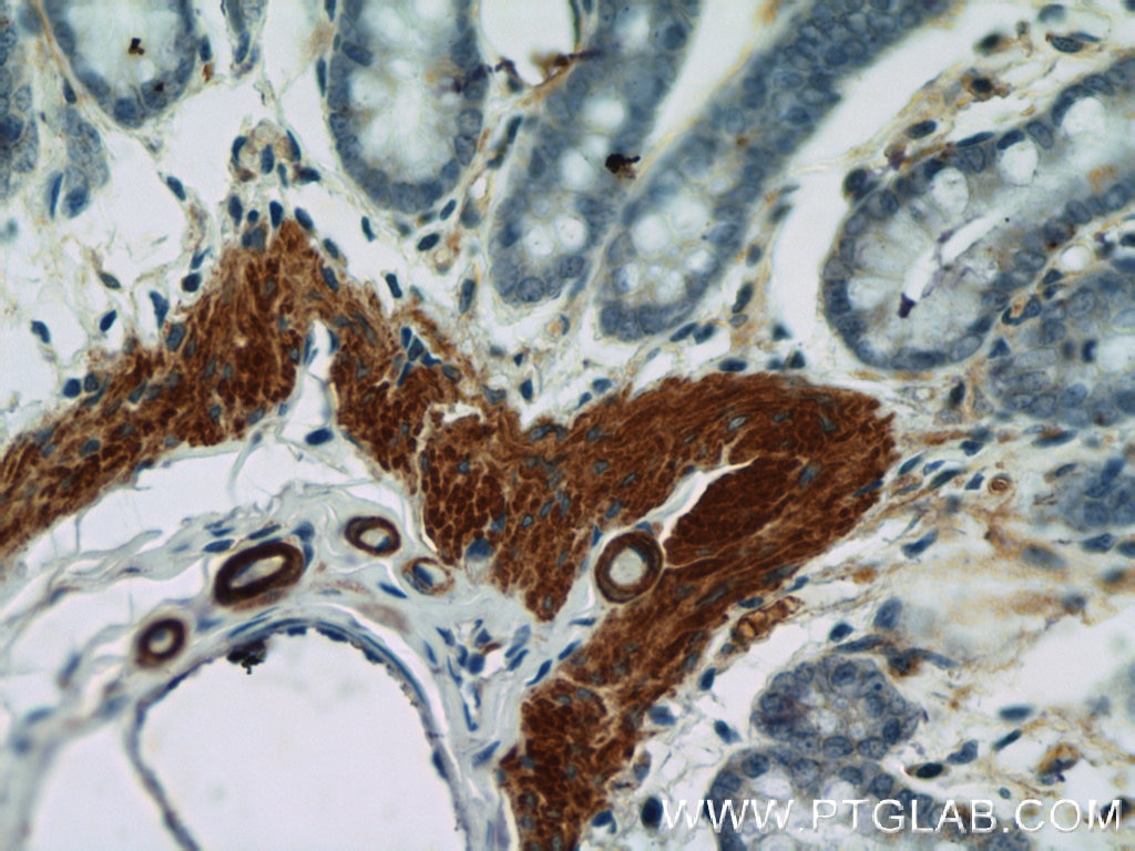 Immunohistochemistry (IHC) staining of rat colon tissue using smooth muscle actin specific Polyclonal antibody (55135-1-AP)