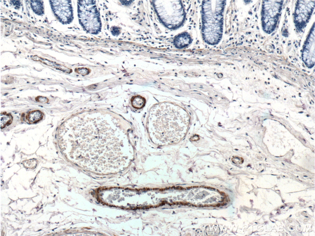 Immunohistochemistry (IHC) staining of human colon tissue using smooth muscle actin specific Polyclonal antibody (55135-1-AP)