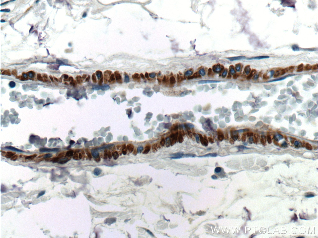 Immunohistochemistry (IHC) staining of human colon tissue using smooth muscle actin specific Polyclonal antibody (55135-1-AP)