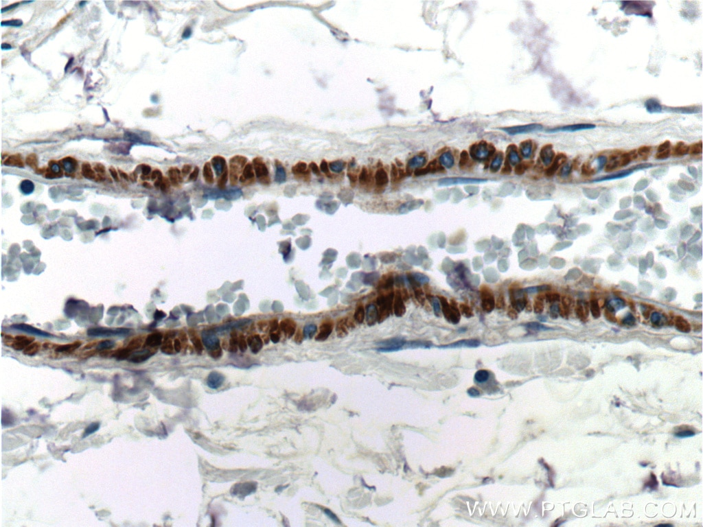 IHC staining of human colon using 55135-1-AP