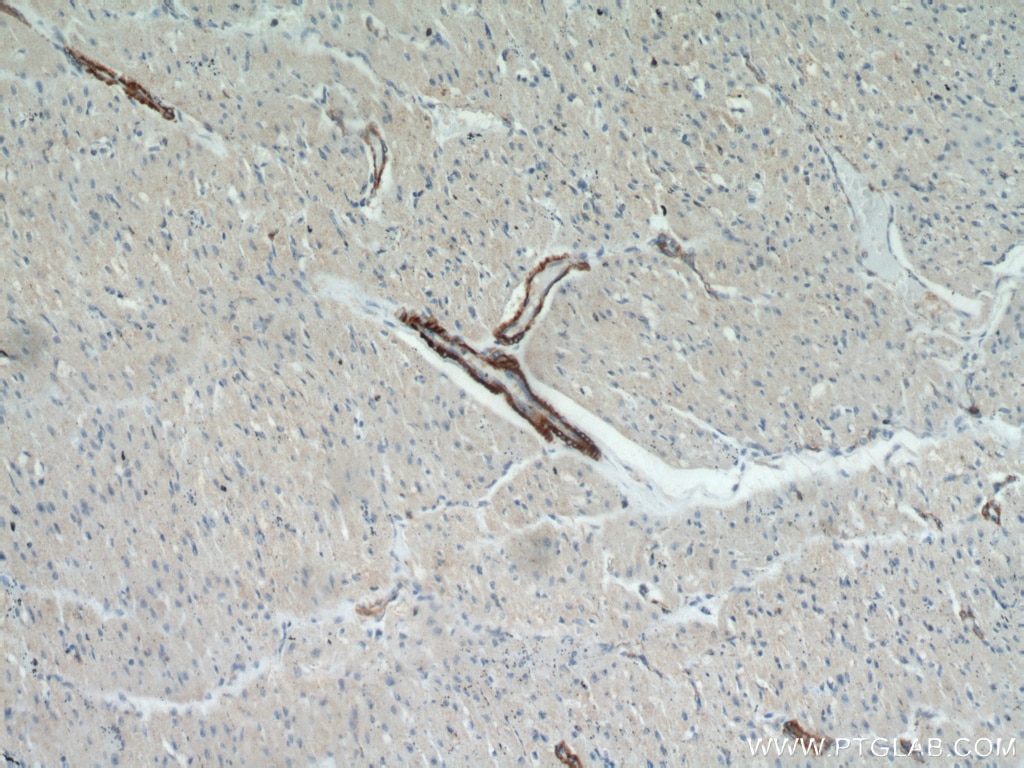 Immunohistochemistry (IHC) staining of human heart tissue using smooth muscle actin specific Polyclonal antibody (55135-1-AP)