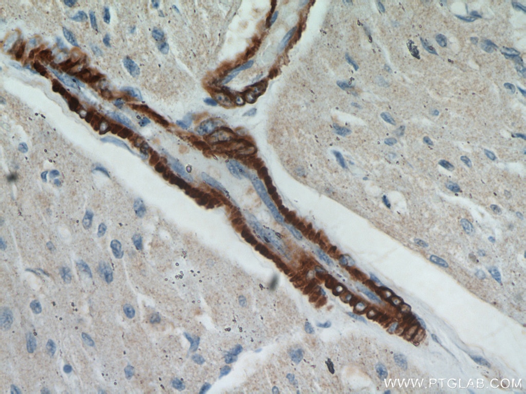 Immunohistochemistry (IHC) staining of human heart tissue using smooth muscle actin specific Polyclonal antibody (55135-1-AP)