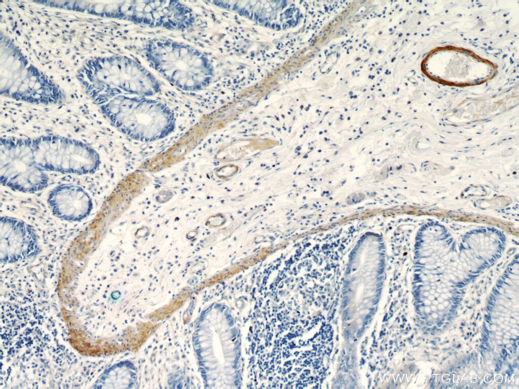 Immunohistochemistry (IHC) staining of human colon tissue using smooth muscle actin specific Polyclonal antibody (55135-1-AP)