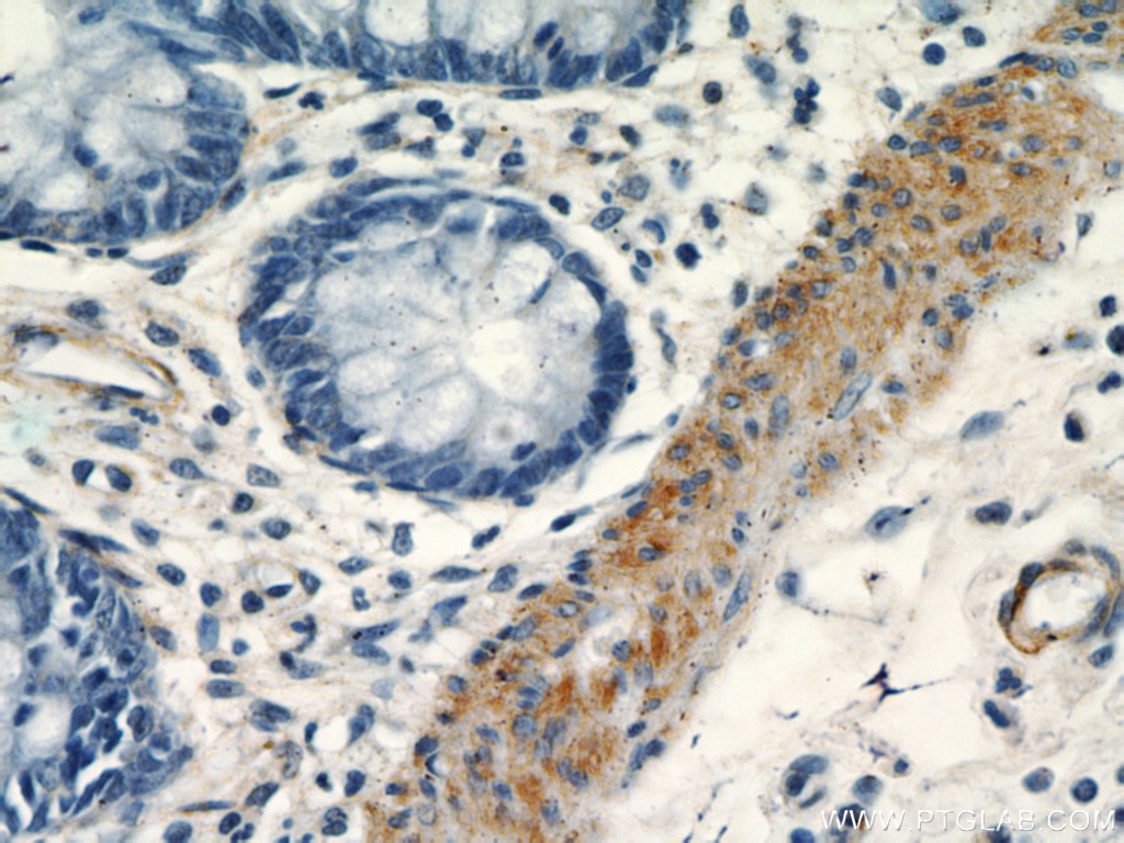 Immunohistochemistry (IHC) staining of human colon tissue using smooth muscle actin specific Polyclonal antibody (55135-1-AP)