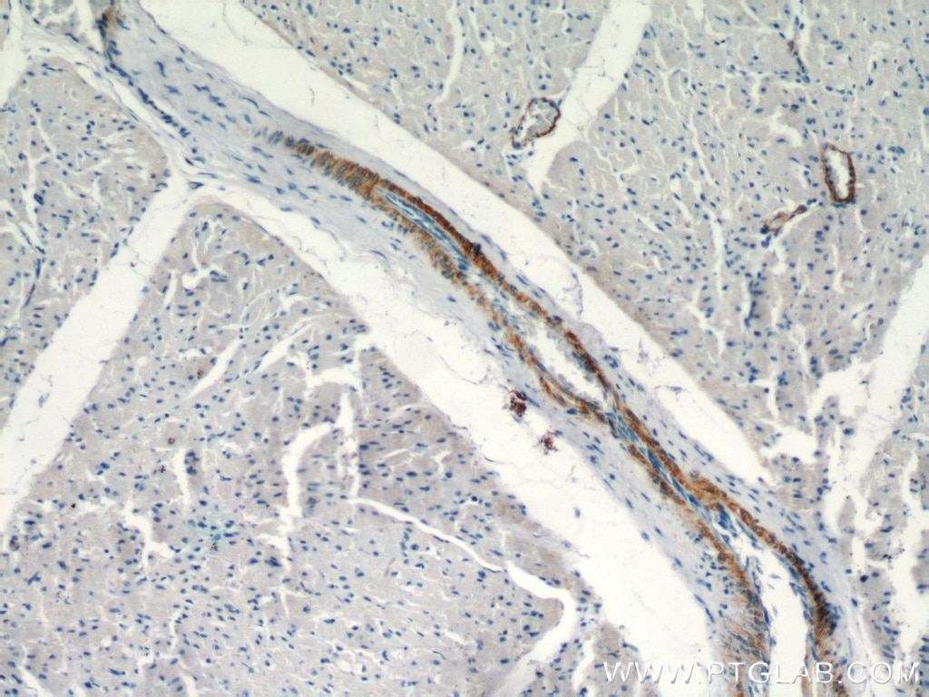 Immunohistochemistry (IHC) staining of human heart tissue using smooth muscle actin specific Polyclonal antibody (55135-1-AP)