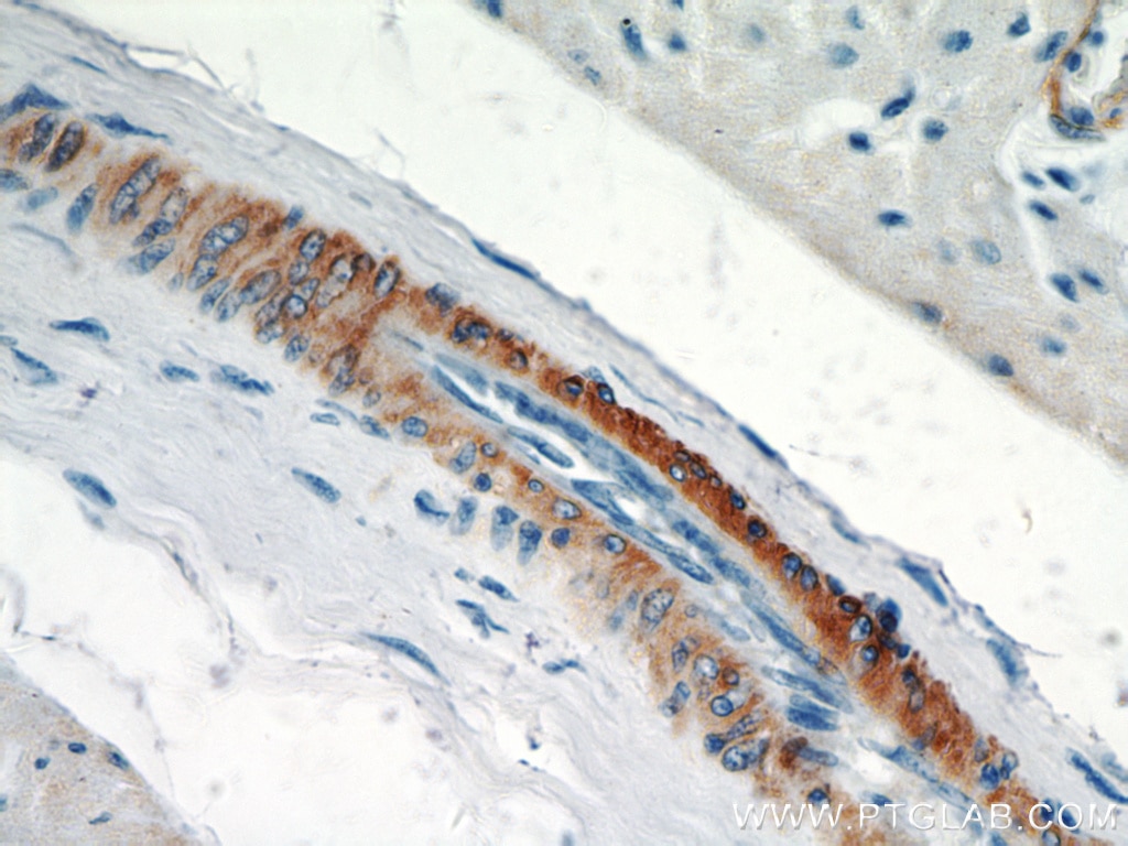 Immunohistochemistry (IHC) staining of human heart tissue using smooth muscle actin specific Polyclonal antibody (55135-1-AP)