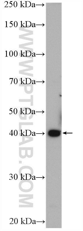 Western Blot (WB) analysis of mouse kidney tissue using smooth muscle actin specific Polyclonal antibody (55135-1-AP)