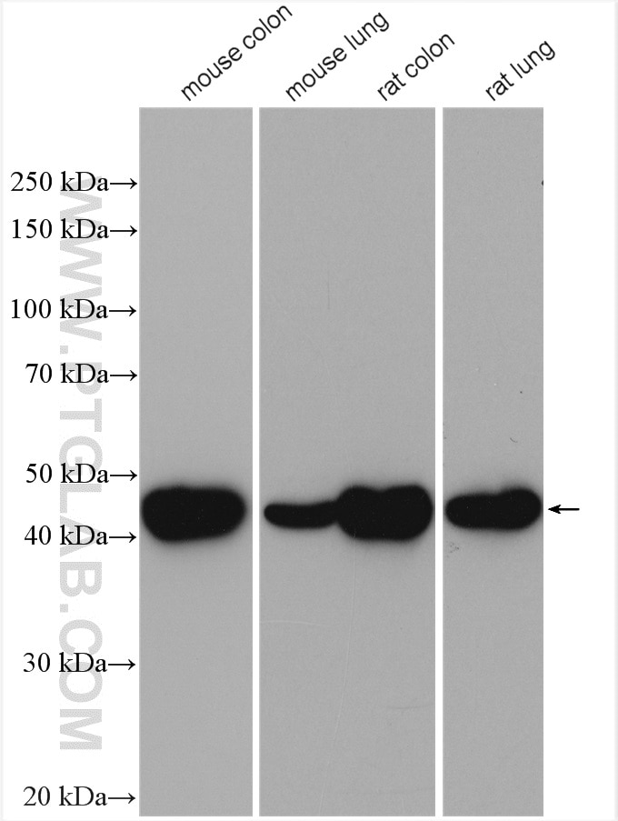 Western Blot (WB) analysis of various lysates using smooth muscle actin specific Polyclonal antibody (55135-1-AP)