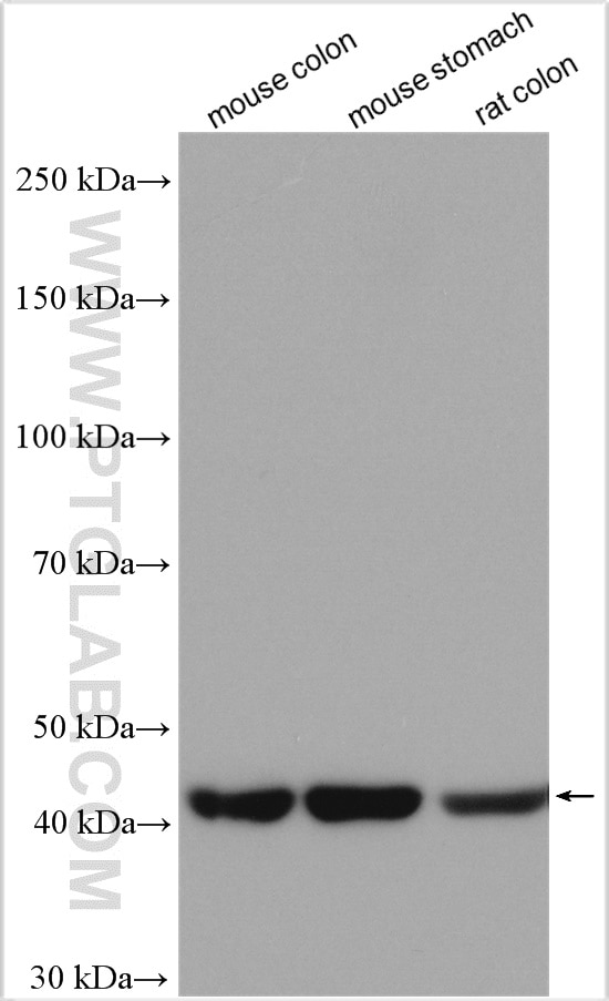 Western Blot (WB) analysis of various lysates using smooth muscle actin specific Polyclonal antibody (55135-1-AP)