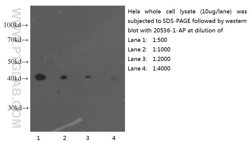 Beta Actin Polyclonal antibody