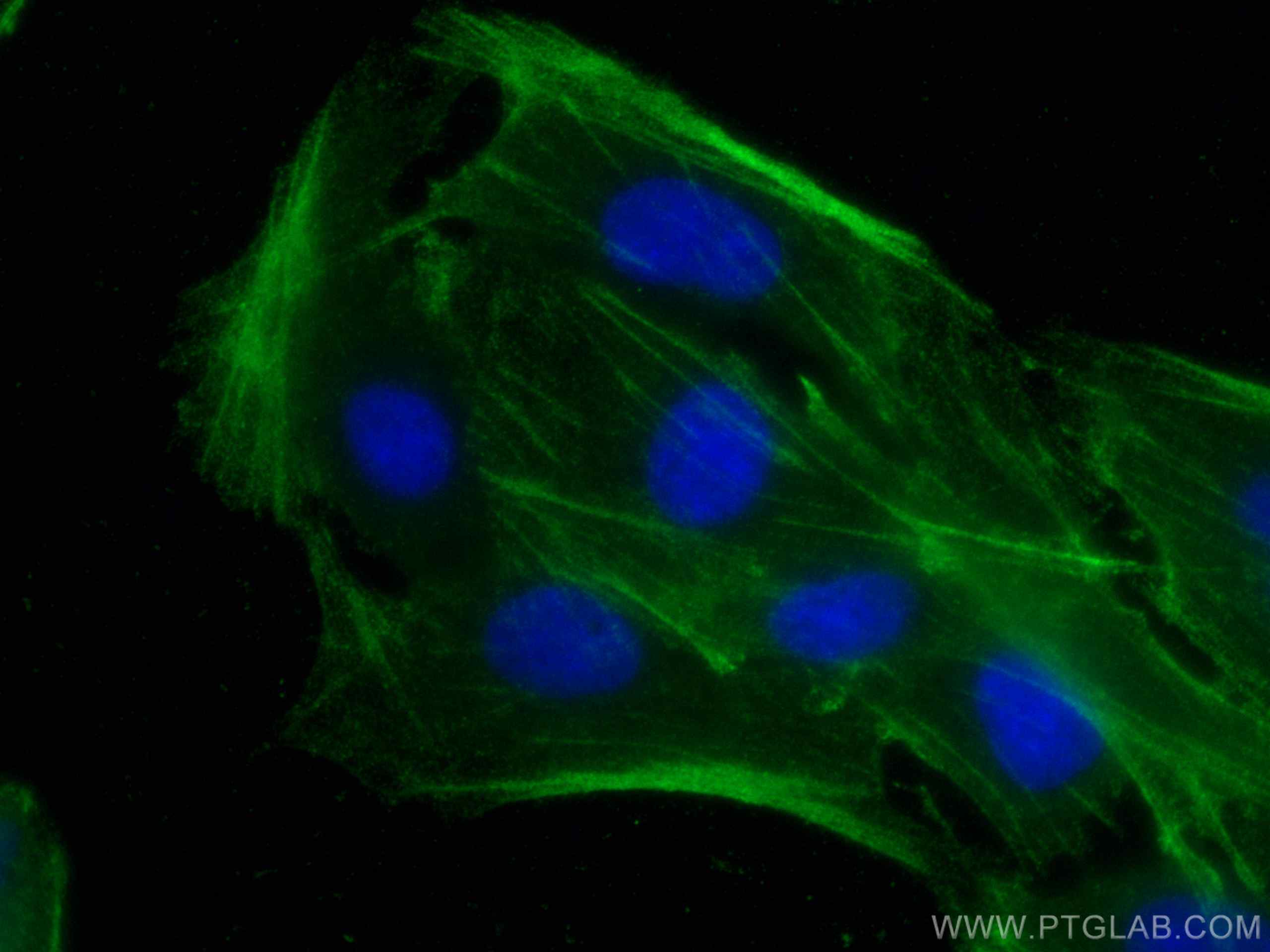 Immunofluorescence (IF) / fluorescent staining of MDCK cells using Beta Actin Polyclonal antibody (20536-1-AP)