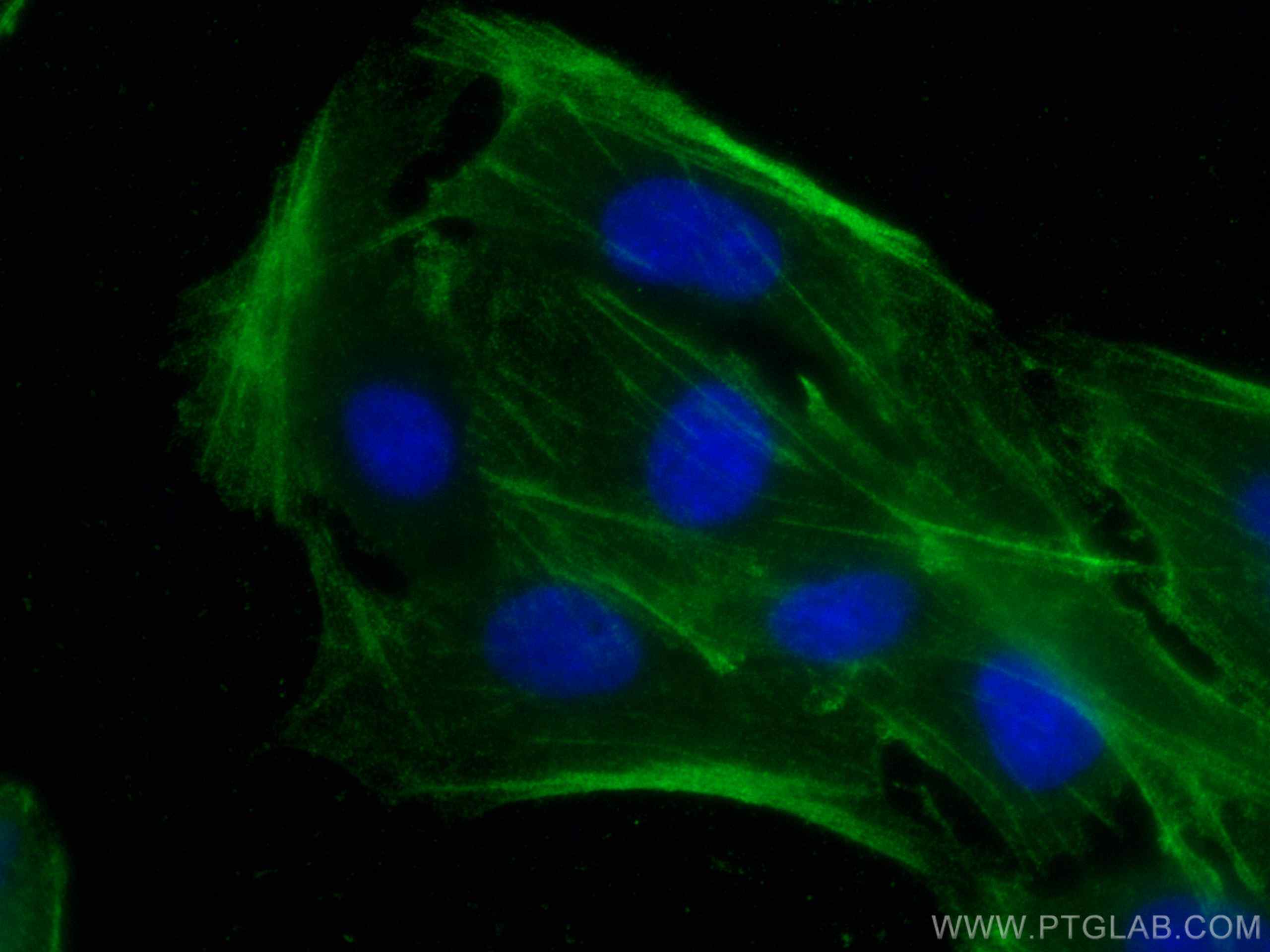 IF Staining of MDCK using 20536-1-AP