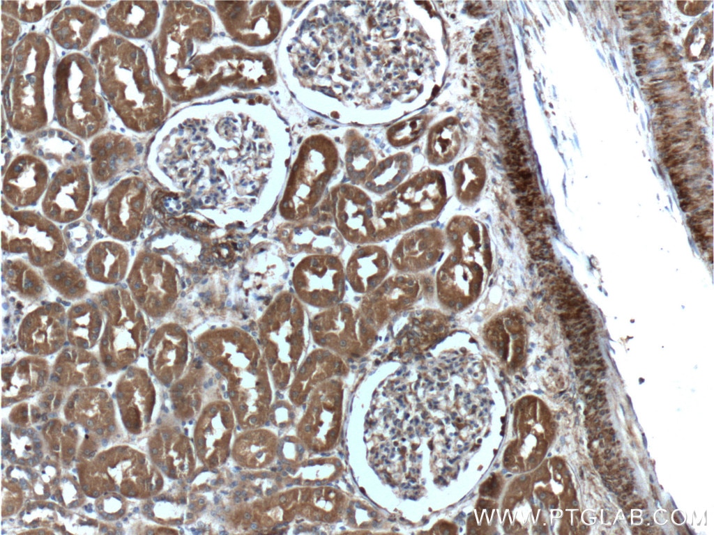 Immunohistochemistry (IHC) staining of human kidney tissue using Beta Actin Polyclonal antibody (20536-1-AP)