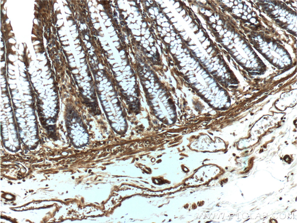 Immunohistochemistry (IHC) staining of human colon tissue using Beta Actin Polyclonal antibody (20536-1-AP)