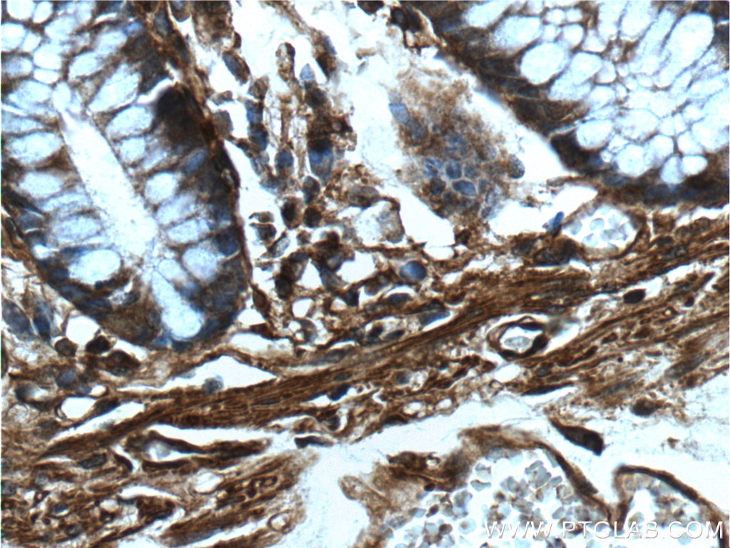 Immunohistochemistry (IHC) staining of human colon tissue using Beta Actin Polyclonal antibody (20536-1-AP)