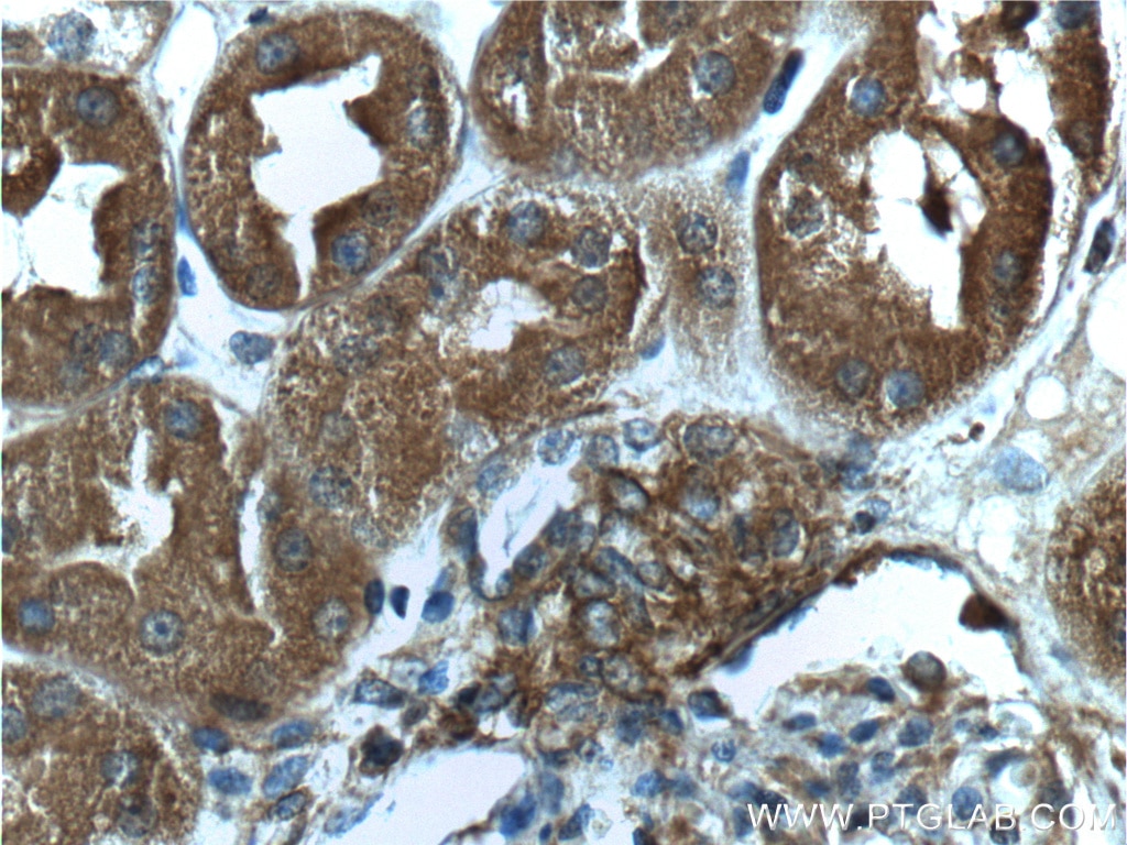 Immunohistochemistry (IHC) staining of human kidney tissue using Beta Actin Polyclonal antibody (20536-1-AP)