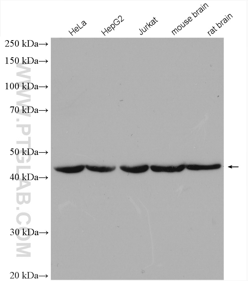 Western Blot (WB) analysis of various lysates using Beta Actin Polyclonal antibody (20536-1-AP)