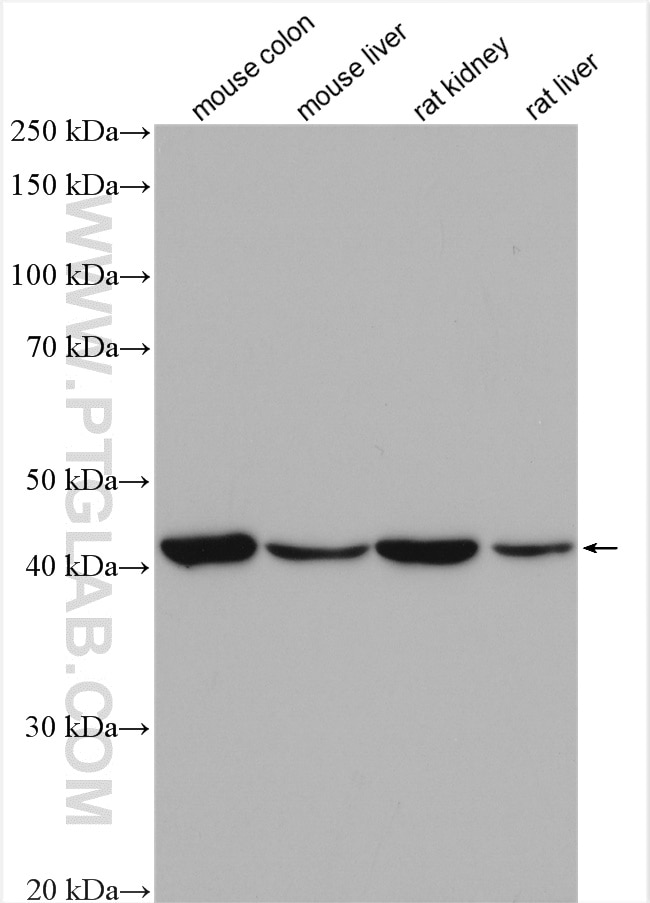 Western Blot (WB) analysis of various lysates using Beta Actin Polyclonal antibody (20536-1-AP)