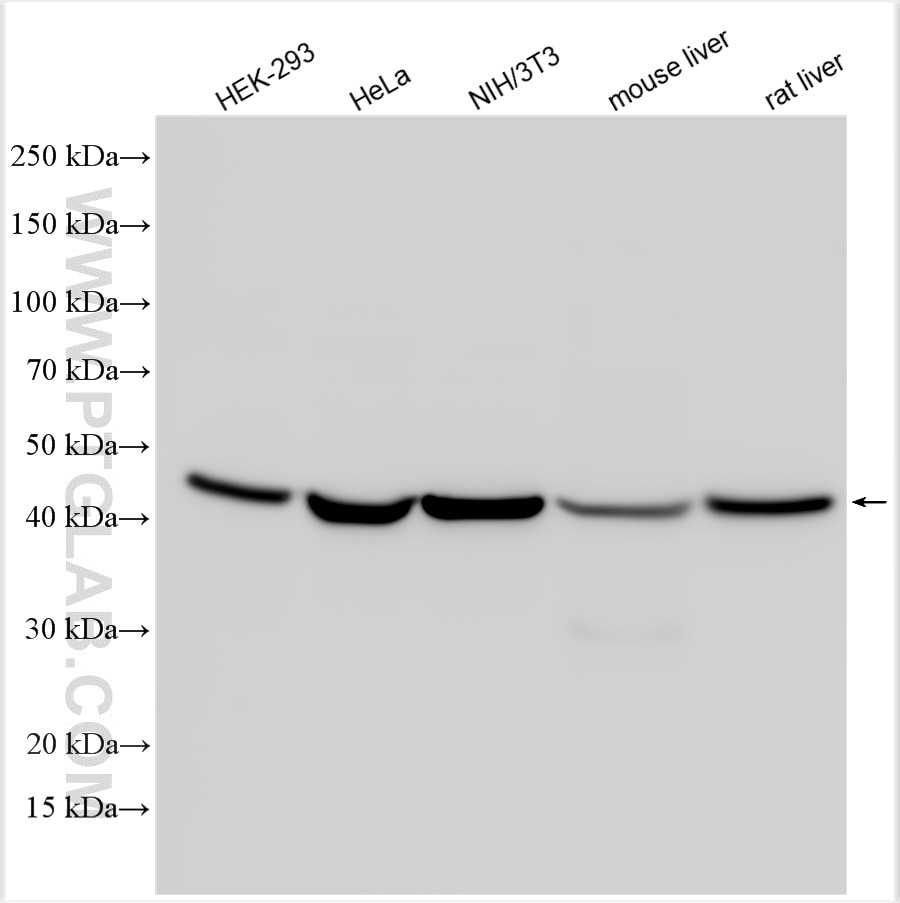 Western Blot (WB) analysis of various lysates using Beta Actin Polyclonal antibody (20536-1-AP)