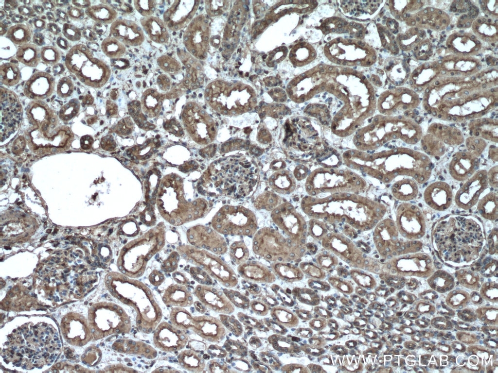 Immunohistochemistry (IHC) staining of human kidney tissue using Beta Actin Monoclonal antibody (60008-1-Ig)