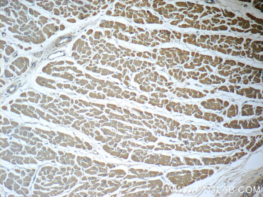 Immunohistochemistry (IHC) staining of human heart tissue using Beta Actin Monoclonal antibody (60008-1-Ig)