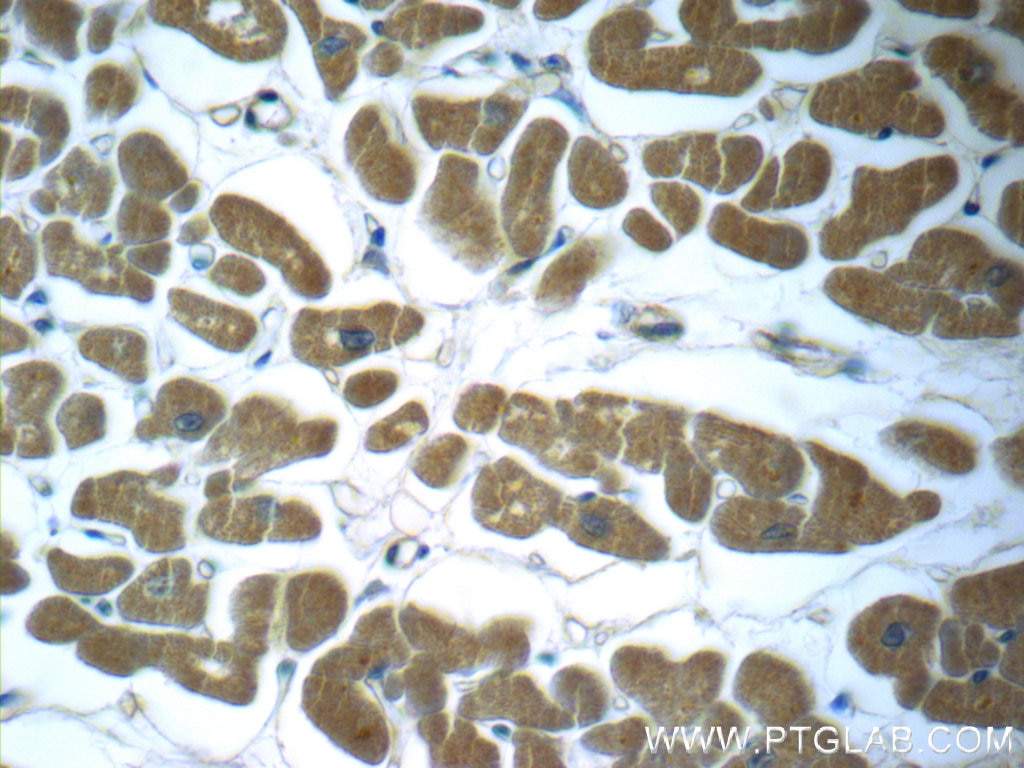 IHC staining of human heart using 60008-1-Ig