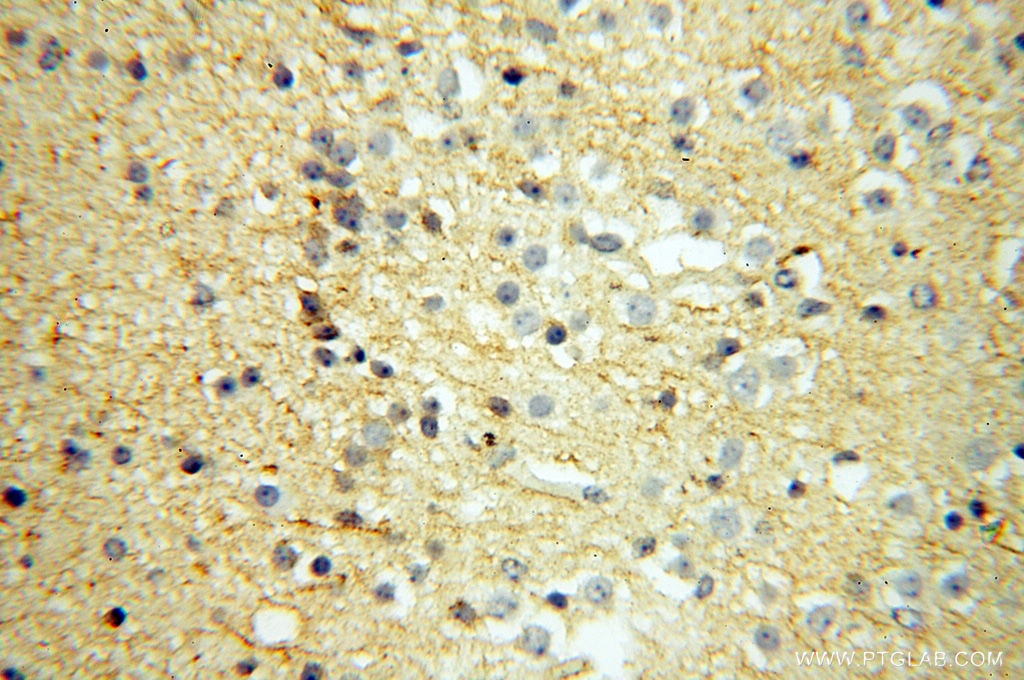 Immunohistochemistry (IHC) staining of human brain tissue using Beta Actin Monoclonal antibody (60008-1-Ig)