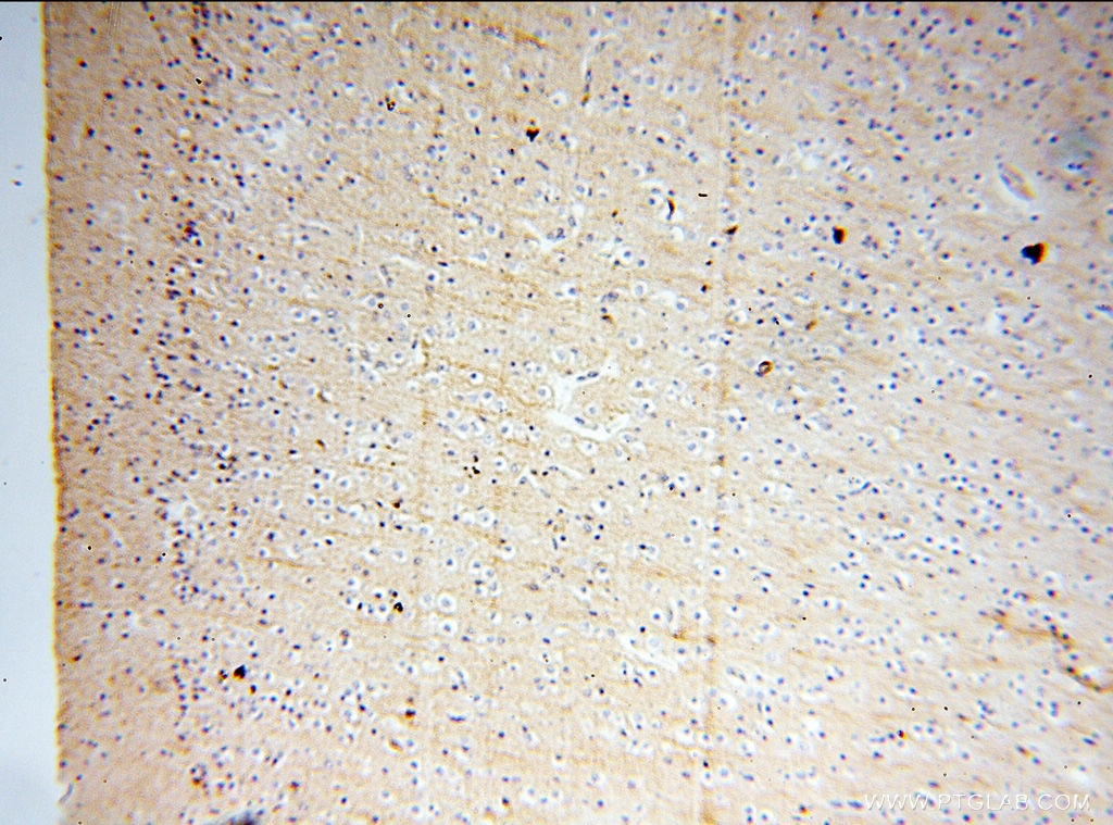 Immunohistochemistry (IHC) staining of human brain tissue using Beta Actin Monoclonal antibody (60008-1-Ig)