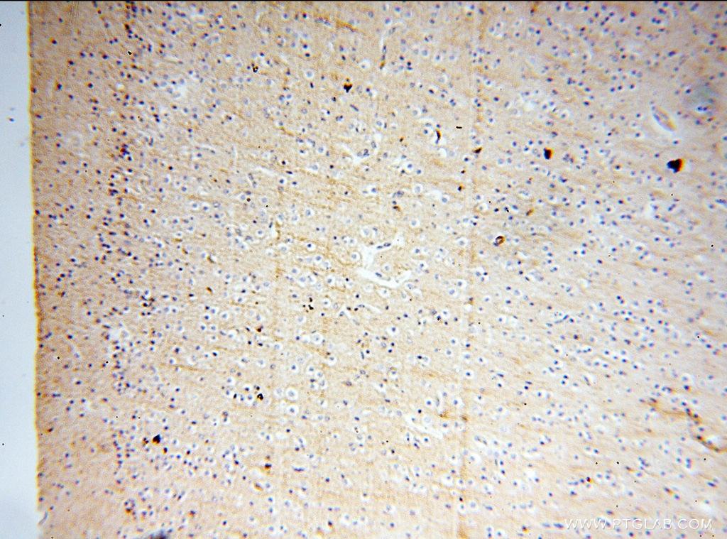 IHC staining of human brain using 60008-1-Ig