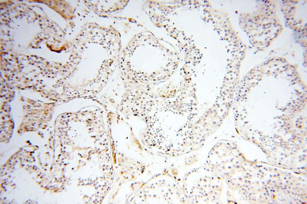 Immunohistochemistry (IHC) staining of human testis tissue using Beta Actin Monoclonal antibody (60008-1-Ig)