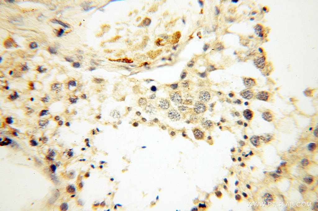 Immunohistochemistry (IHC) staining of human testis tissue using Beta Actin Monoclonal antibody (60008-1-Ig)